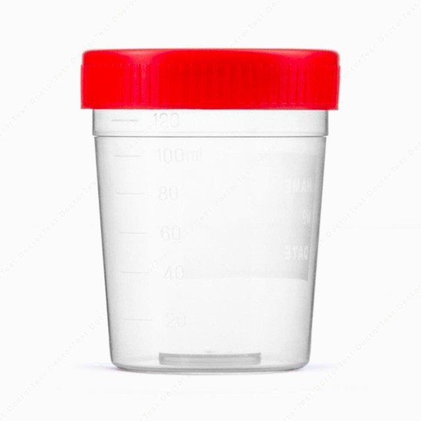 Frasco para recogida de muestras - 150 ml